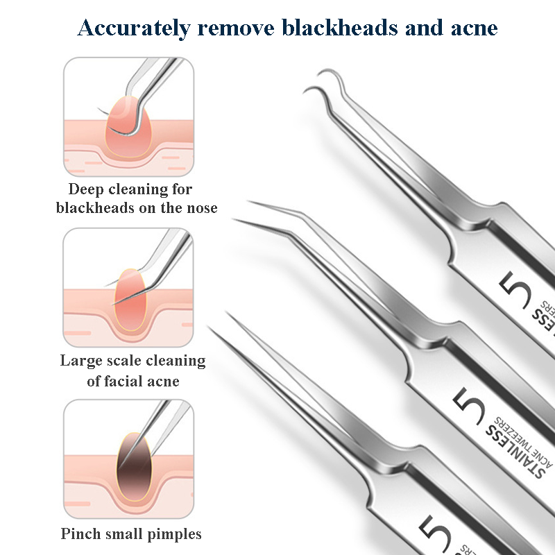 4-11Pcs Ingrown Hair Tweezers  - Hair Care Clinic recension och pris