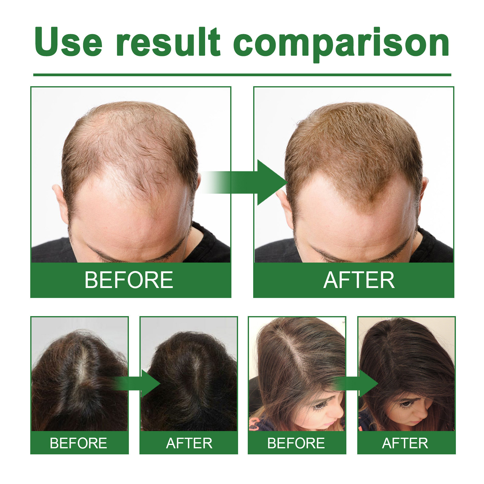 Rosemary Spray for Hair Nouris - Hair Care Natur recension och pris